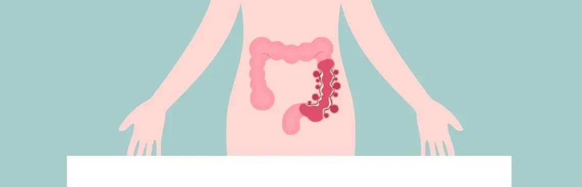 IBS-D Image of IBS-D